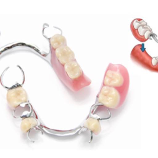 Próteses Dentarias por Dra. Luciana Thomé
