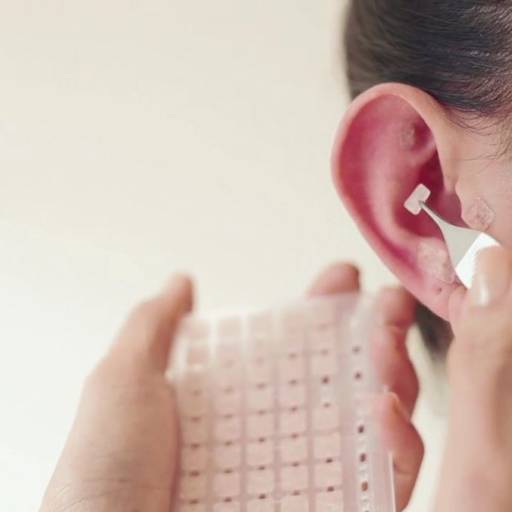 Auriculoterapia em Americana, SP por Regiane Rodrigues Estética e Bem Estar 