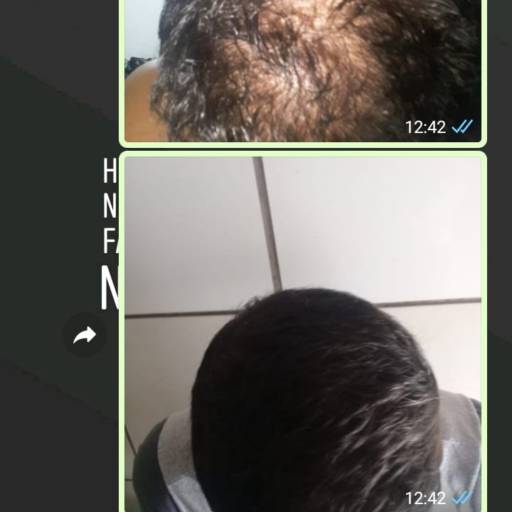 FEMME LIFT Hair, Skin & Nails em Bauru, SP por Nilza & Geraldo Amaral Representante Hinode  Bauru