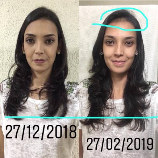 FEMME LIFT Hair, Skin & Nails em Bauru, SP por Nilza & Geraldo Amaral Representante Hinode  Bauru