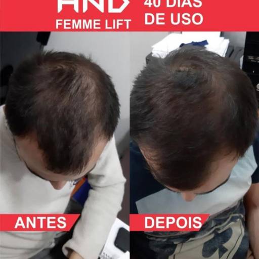 FEMME LIFT Hair, Skin & Nails em Bauru, SP por Nilza & Geraldo Amaral Representante Hinode  Bauru