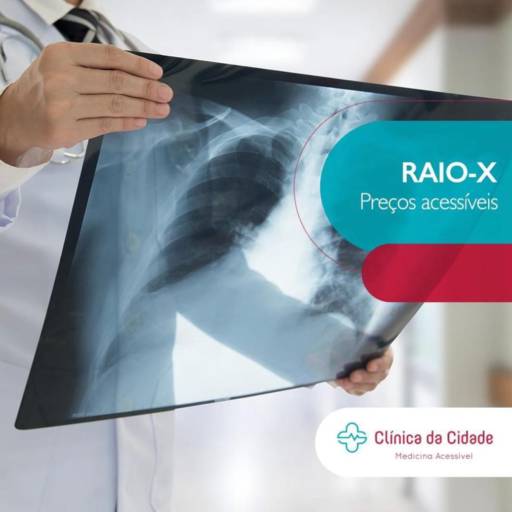 RAIO X  por Clínica da Cidade Medicina Acessível
