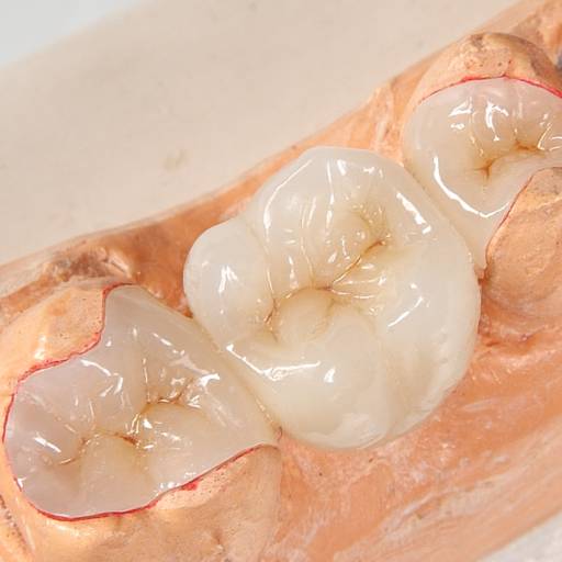 Inlay/Onlay por Consultório Odontológico Karla Neme Farha