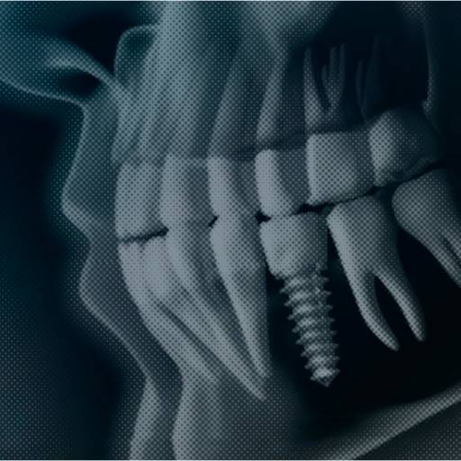 Comprar o produto de Guia Cirúrgico para Implantes em Odontologia Digital pela empresa Top Radio - Radiologia Odontológica em Atibaia em Atibaia, SP por Solutudo