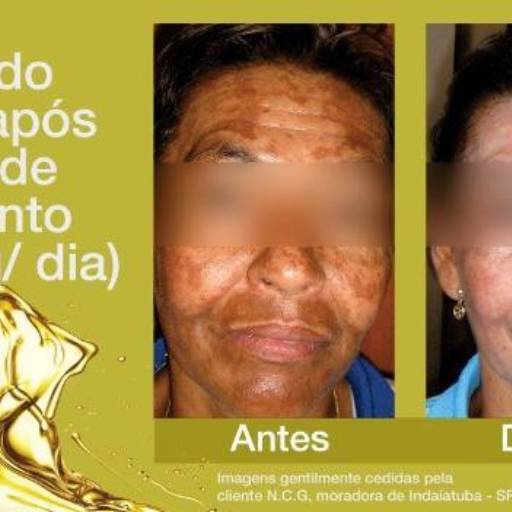 OLI OLA - O AUTÊNTICO PEELING EM CÁPSULAS