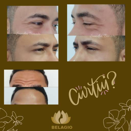 Comprar o produto de BOTOX (Toxina Botulinica) em Clínicas de Estética e Beleza pela empresa BELAGIO em Botucatu, SP por Solutudo