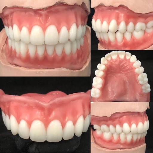 Prótese Total  por Dra. Nathália Quirino Bueno