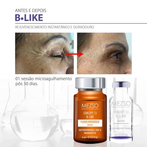 Botox Like  em Americana, SP por Mezzo Dermocosméticos Americana 