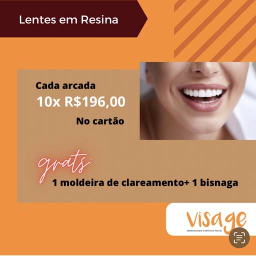 Facetas em Resina