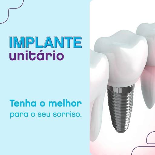 Comprar o produto de Implante Unitário  em Odontologia pela empresa Odontoclinic  Americana - Ipiranga  em Americana, SP por Solutudo