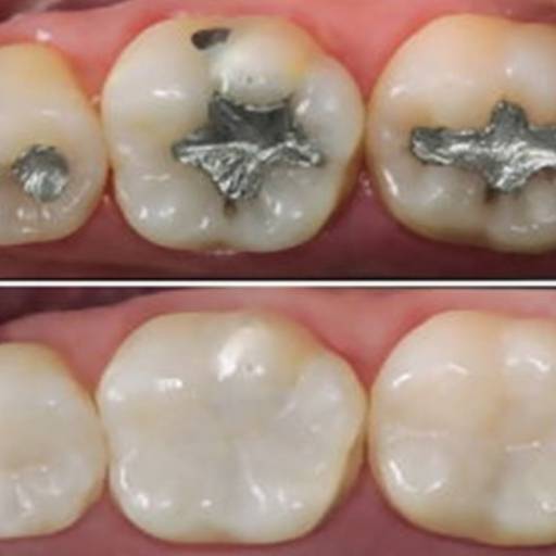Restauração Estética por Dra. Nathália Quirino Bueno
