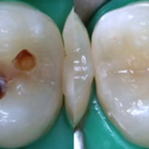 Restauração Estética