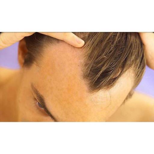 Minoxidil 5% Loção Capilar 100ml em Itapetininga, SP por Coop Life Fórmulas