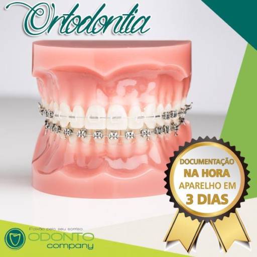 Comprar o produto de ORTODONTIA em Outros Serviços pela empresa Squadra Odontologia Integrada em Foz do Iguaçu, PR por Solutudo