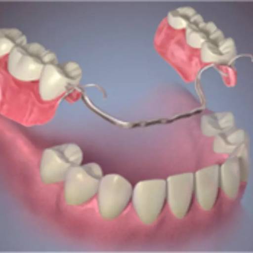 Prótese Parcial Removível em Bauru